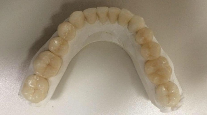 Clínica Odontología Integral Bugambilias - REHABILITACION