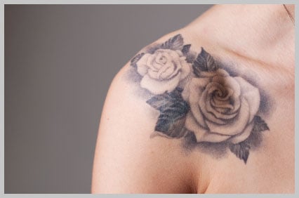 Safe laser tattoo removal||||