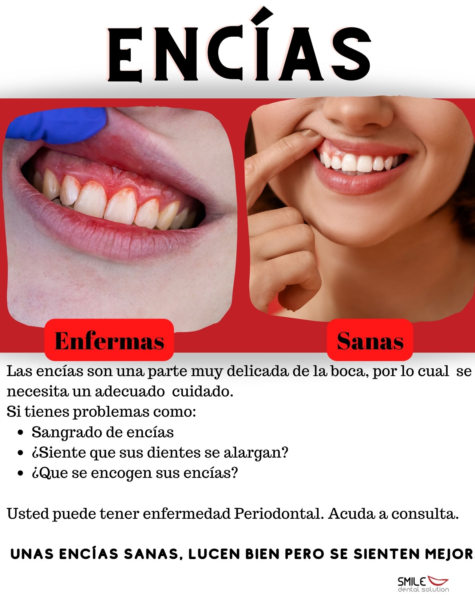 Encías