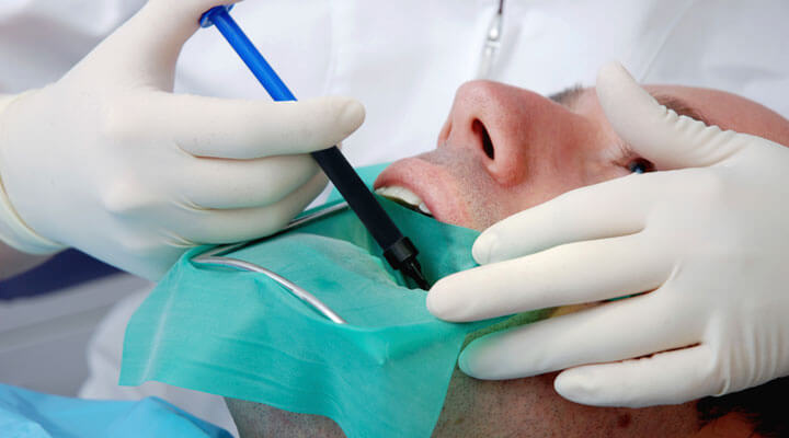 Micro Dental de San Miguel - LIMPIEZA