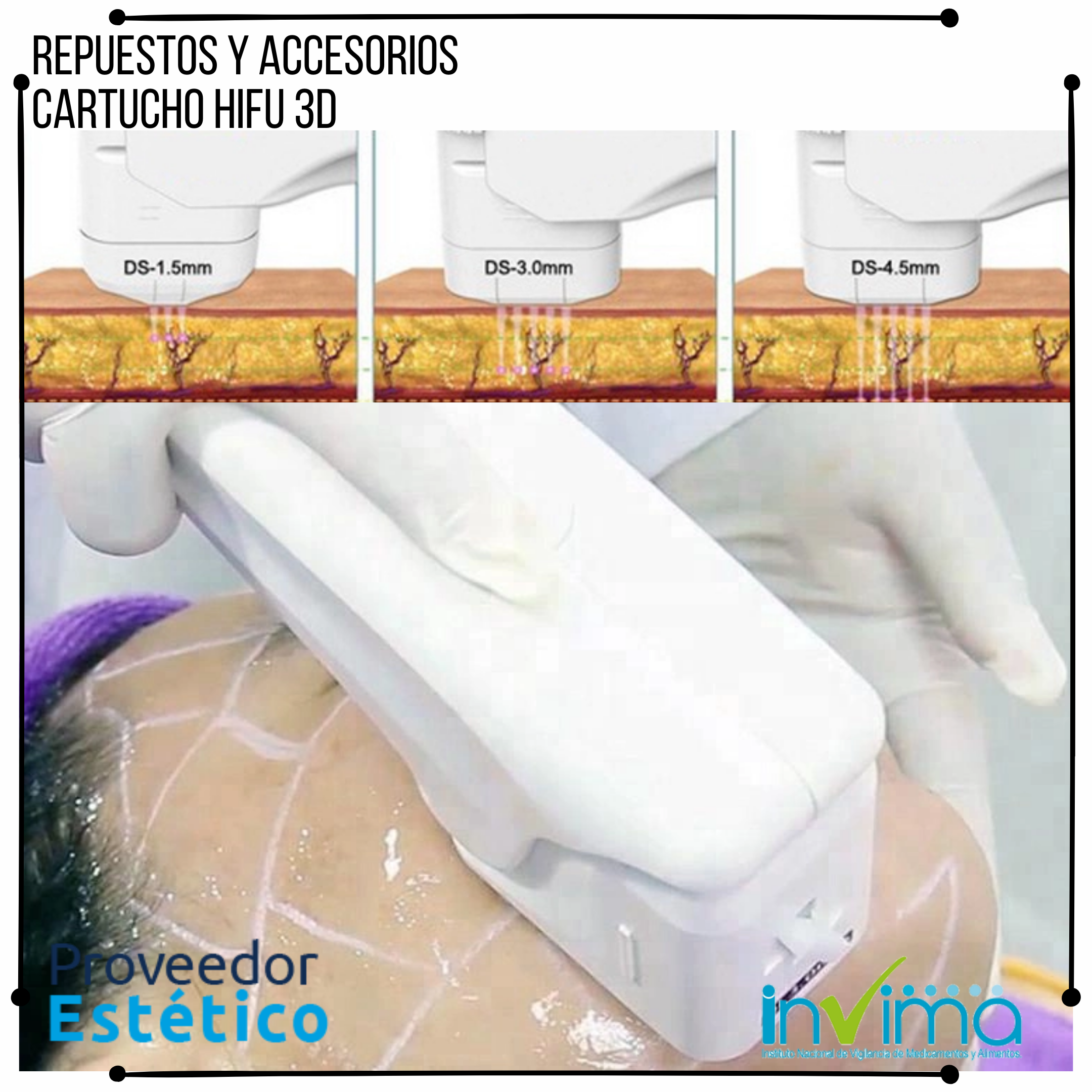 https://0201.nccdn.net/4_2/000/000/000/c4a/cartucho-hifu-3d--3-.png