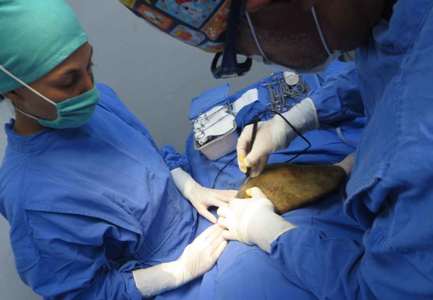 Dentro del equipo utilizado en quirófano contamos con un electrocauterio. Esta pequeña herramienta nos permite hacer disección de tejidos minimizando el sangrado durante la cirugía.
