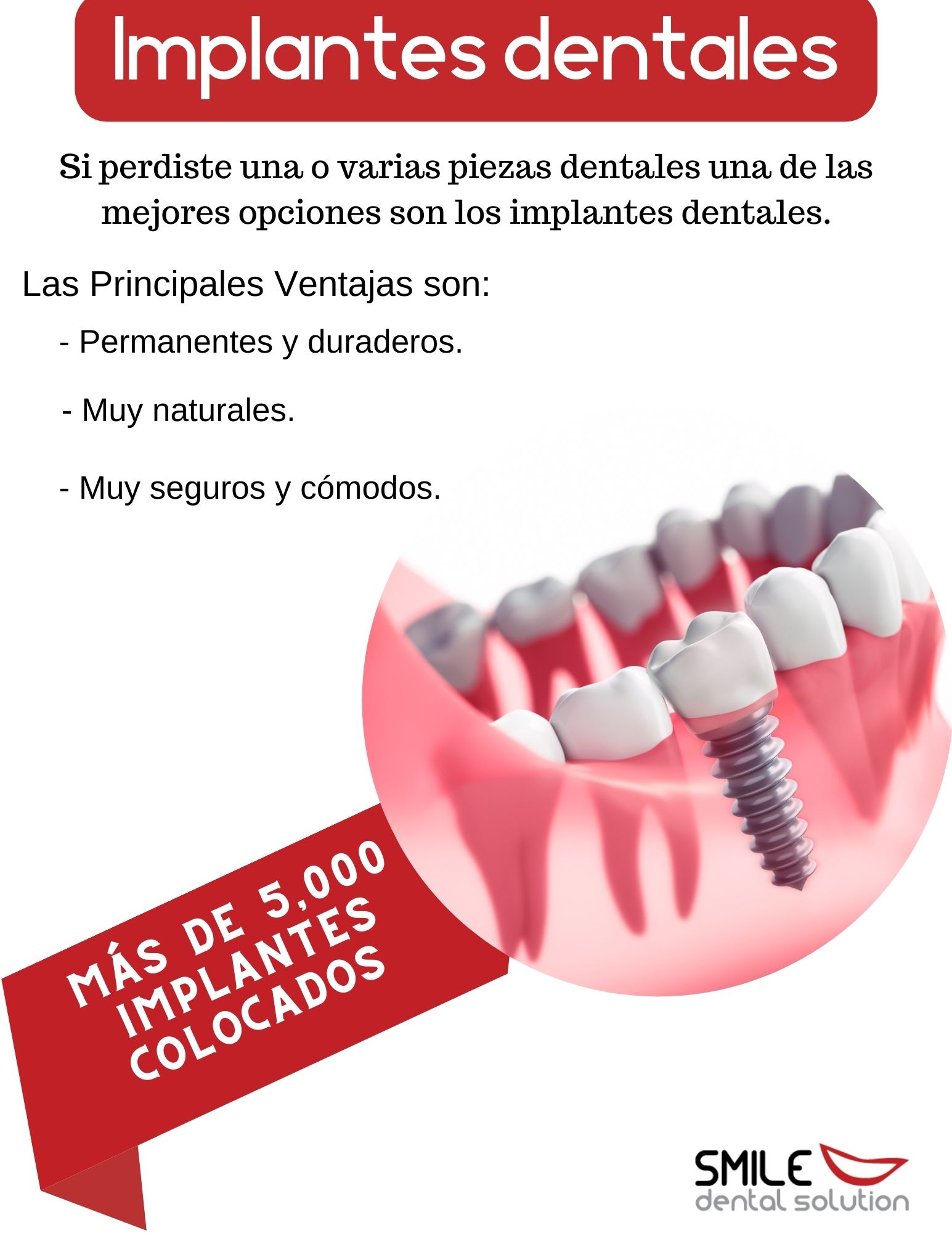 https://0201.nccdn.net/4_2/000/000/017/e75/implantes-sds.jpg