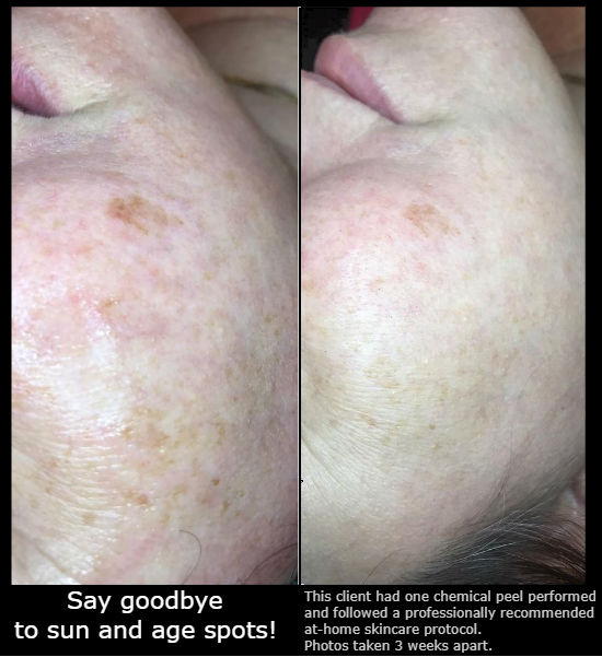 Skin Treatment Before-and-After