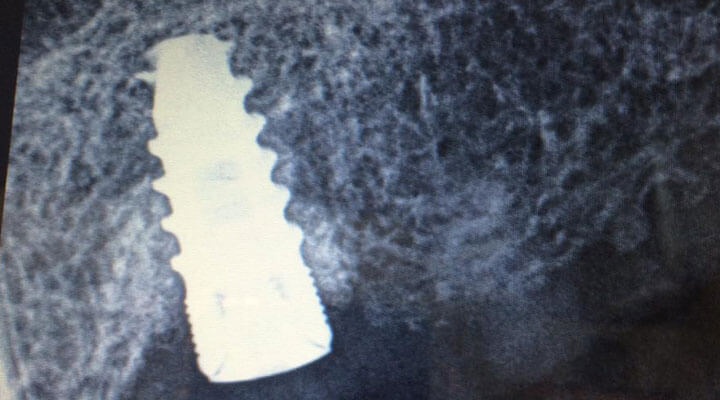 Clínica Odontología Integral Bugambilias - TECNICAS AVANZADAS
