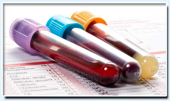 Laboratorio Biovida - análisis de sangre