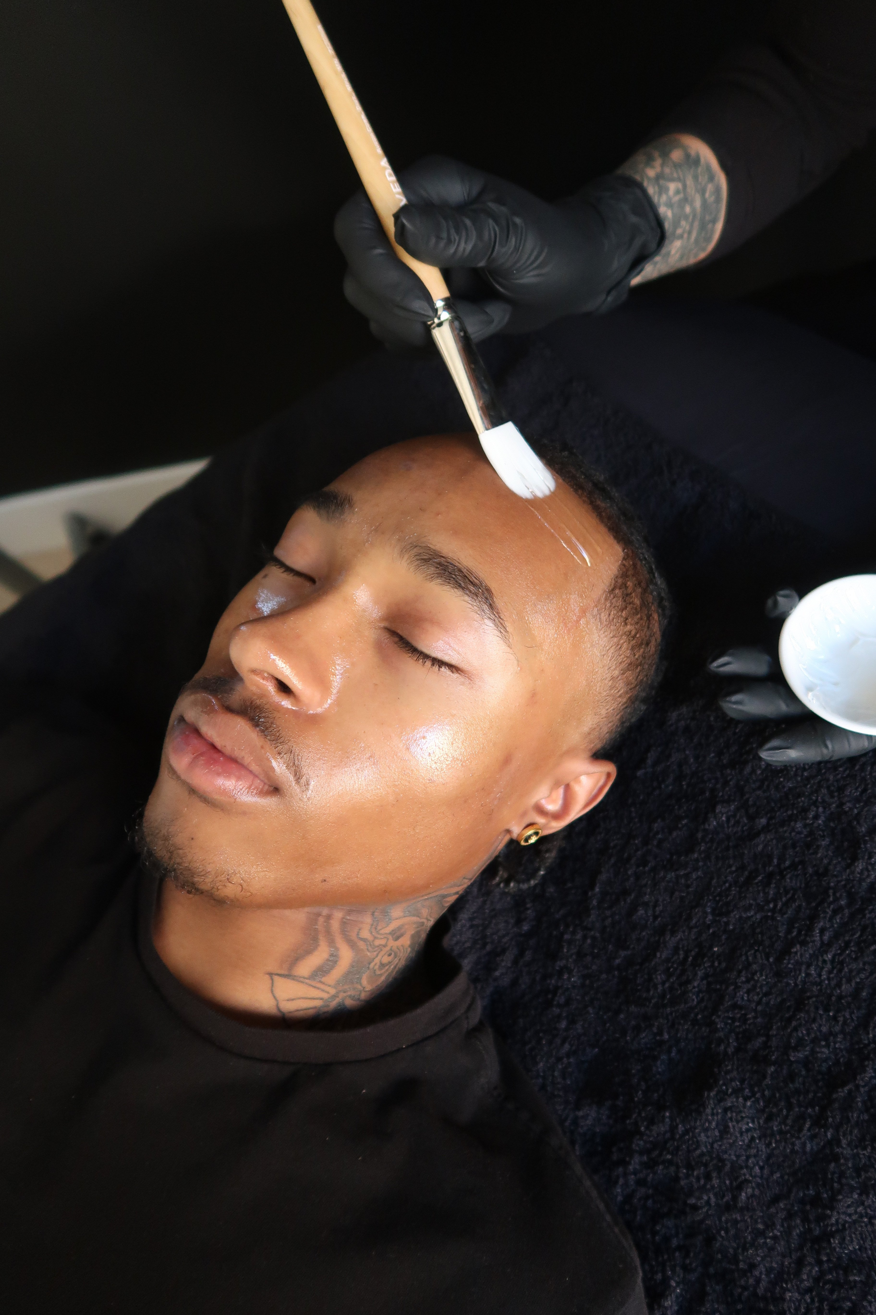 Woman having chemical peel