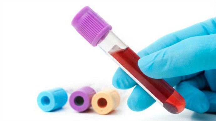 Atimed Medicina E Segurana A Do Trabalho Exame De Sangue Rapido Pode Diminuir O Uso Desnecessario De Antibiotico