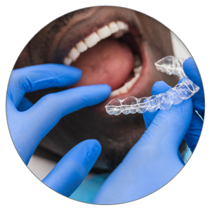 Close up of a dental hygienist fitting a retainer