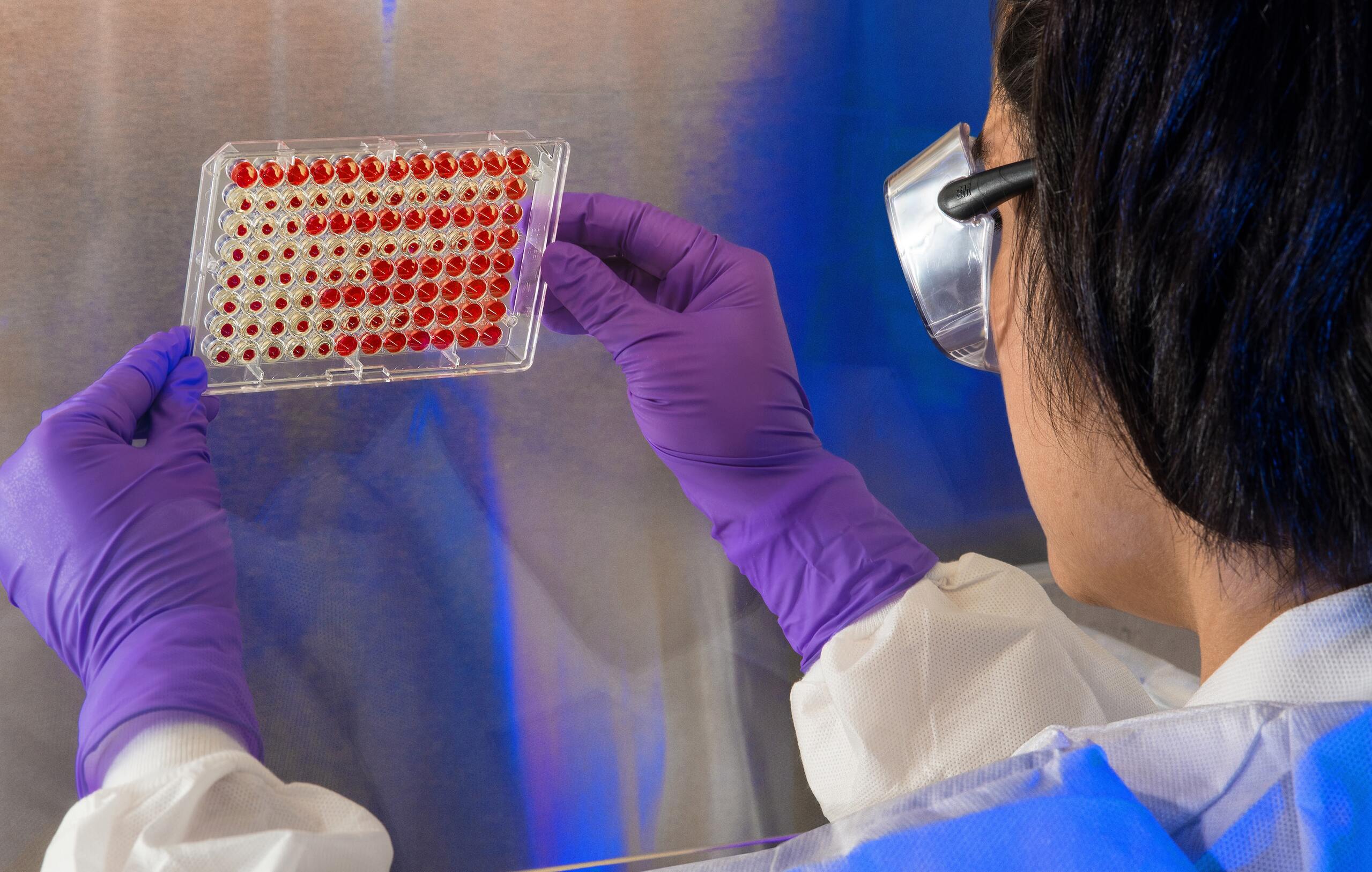 Científico con guantes morados y gafas protectoras sosteniendo placa de laboratorio con muestras rojas.