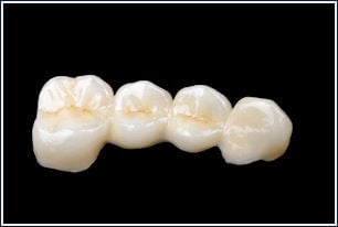 Dental Implants Dental Bridge Dentures Graves Dental