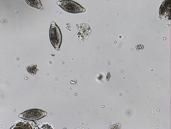 Huevo de trichuris