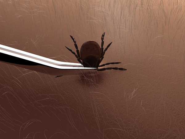 Pulling tick out of skin||||