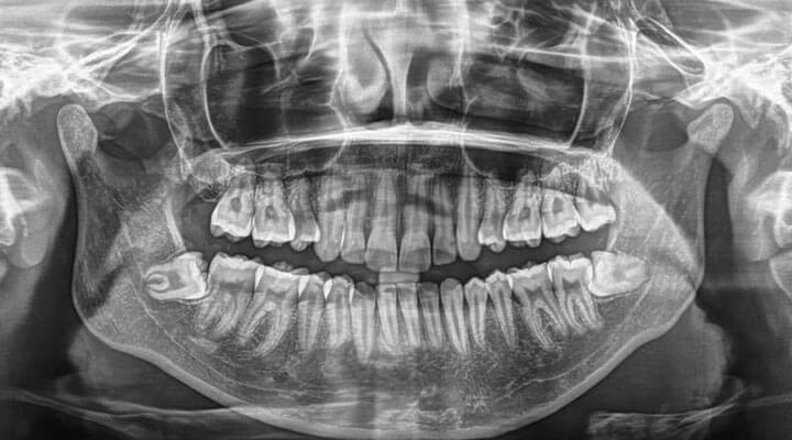 Clínica Odontología Integral Bugambilias - ODONTOPEDIATIRA