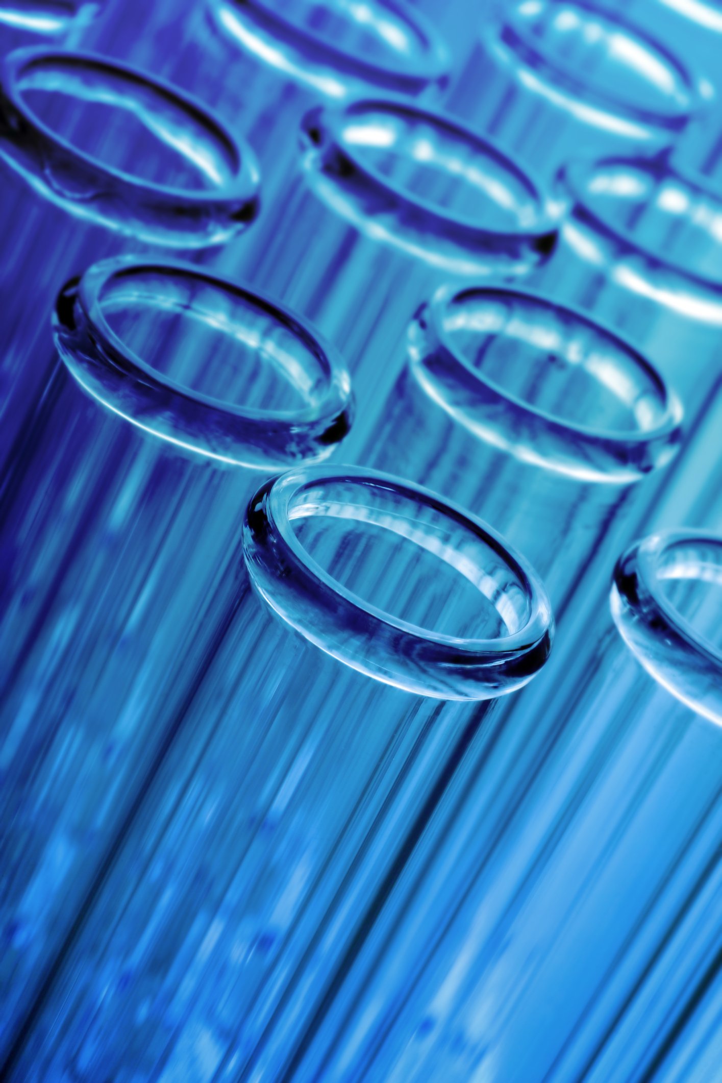 (##AI##(Background.image2.alt)##AI##)