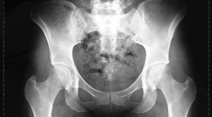 Imagenología De La Cruz SC - ANGIOTOMOGRAFIA