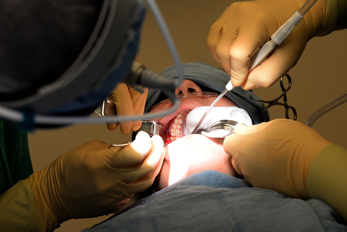 Cirugía oral y maxilofacial - Wikipedia, la enciclopedia libre