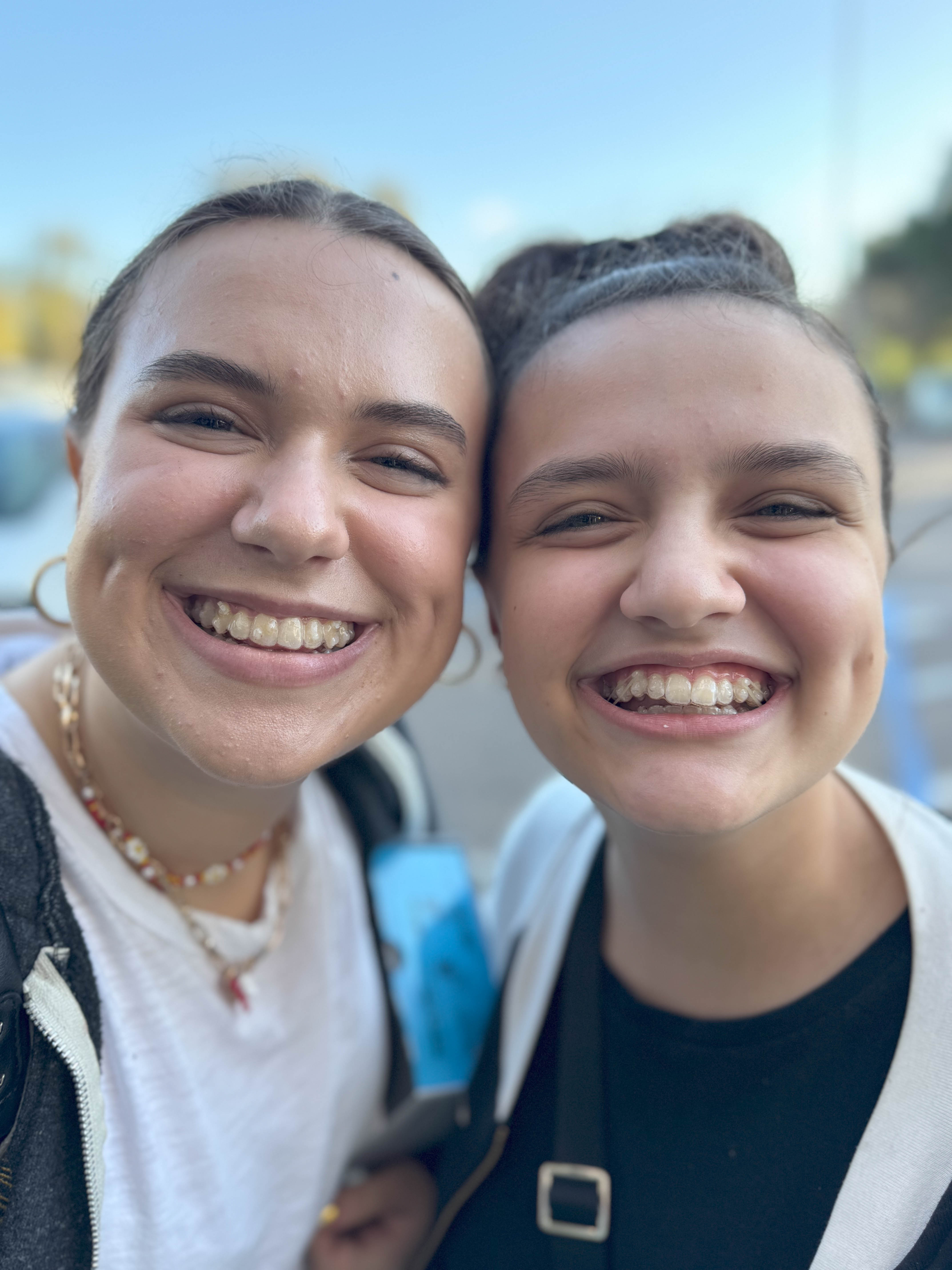 Invisalign twins