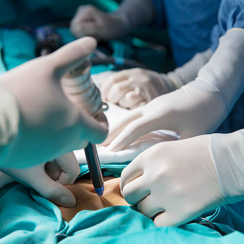 Médico Cirujano Baudelio Flores Aguirre - Cirugía General