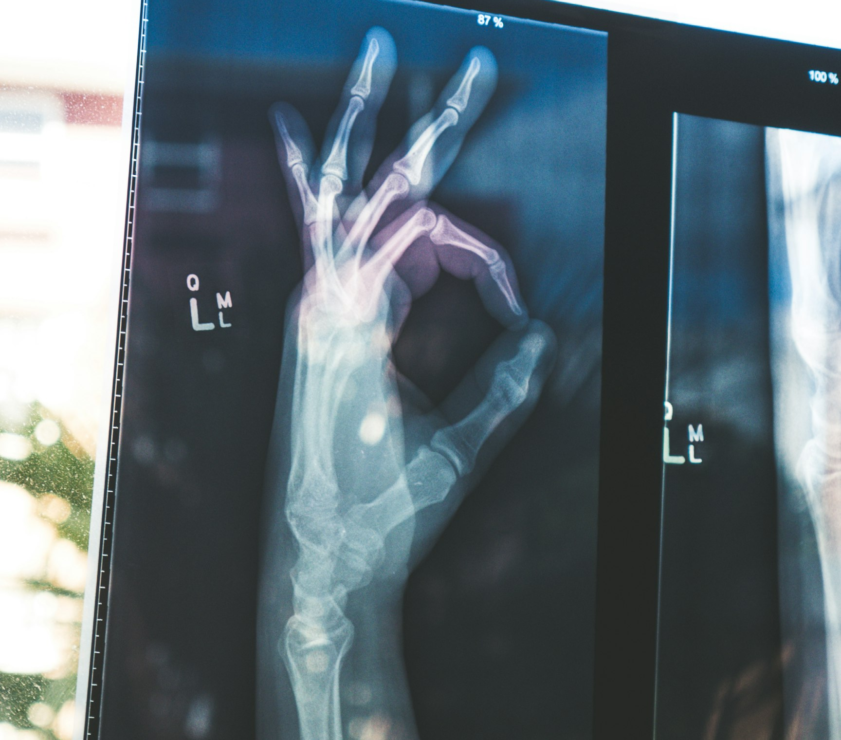 Sala de resonancia magnética moderna con escáner médico y equipo tecnológico avanzado en ambiente hospitalario.