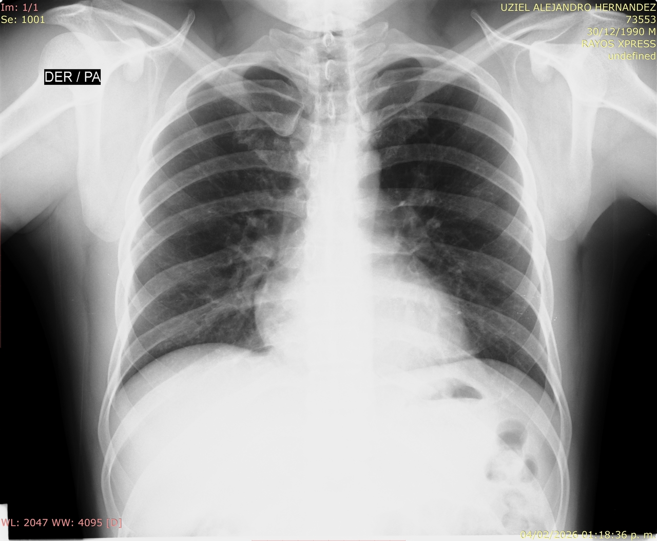 a set of wooden blocks spelling the word mental