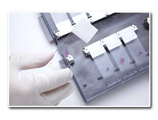 Dr. Rubén González Romo - citología Dr. Rubén González Romo - citología