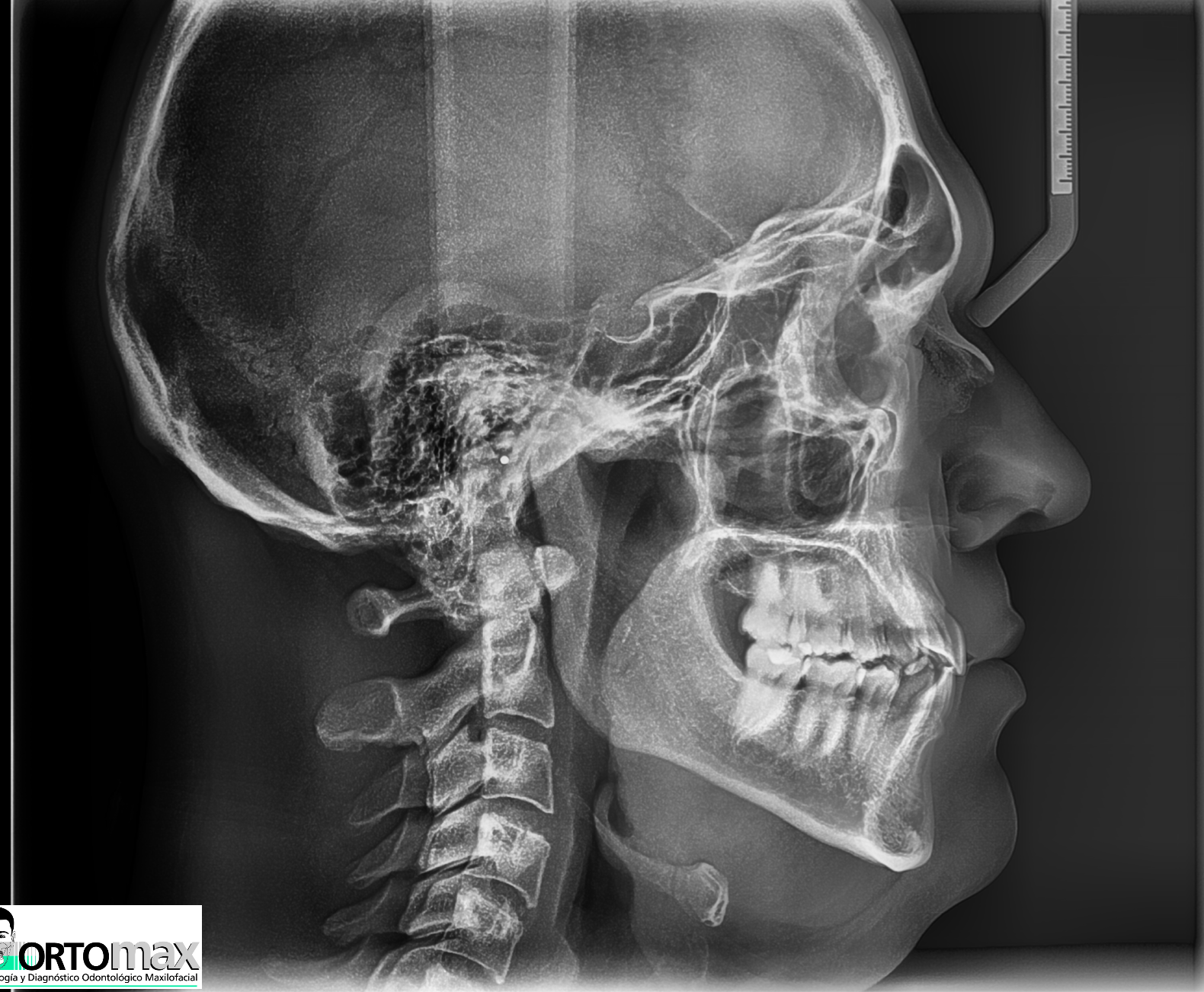 Médica atendiendo a paciente en tomógrafo computarizado con imagen cerebral en pantalla
