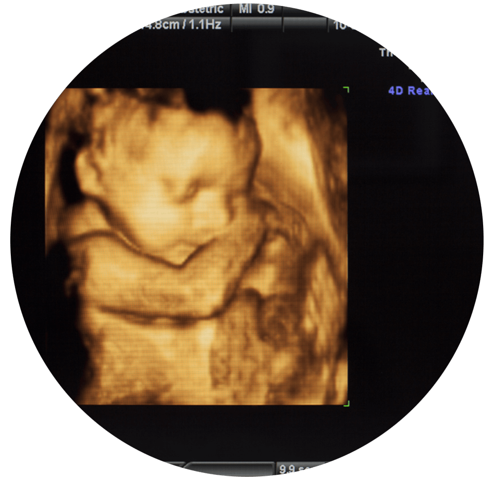 RADIOLOGIA E IMAGEN DEL MANTE SA DE CV - ULTRASONIDO 4D