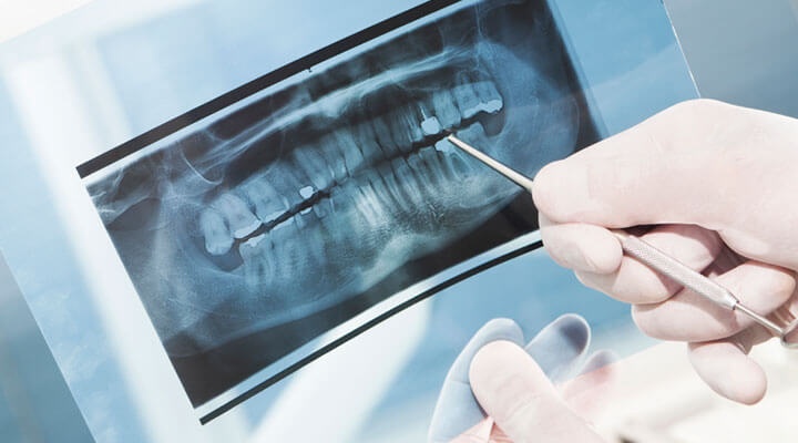 Dental Harmony S.A. de C.V. - RAYOS X