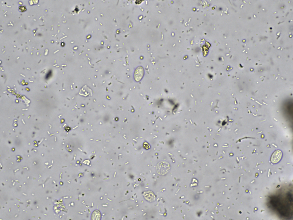 Giardia lamblia