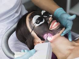 Hollywood Peel Carbon Laser Facial Peel